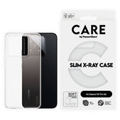 Étui X-Ray pour Xiaomi 15T Pro 5G, transparente, CARE